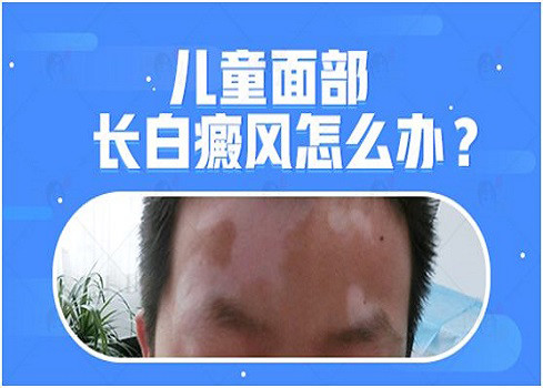 贵州白癜风医院